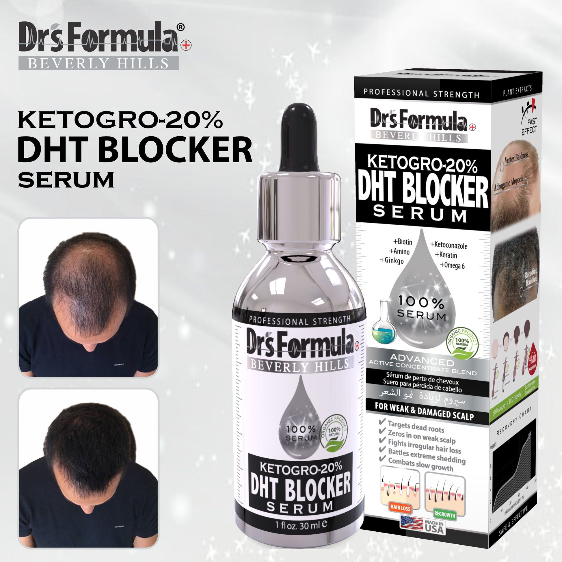 Ketogro-20% DHT Blocker Serum